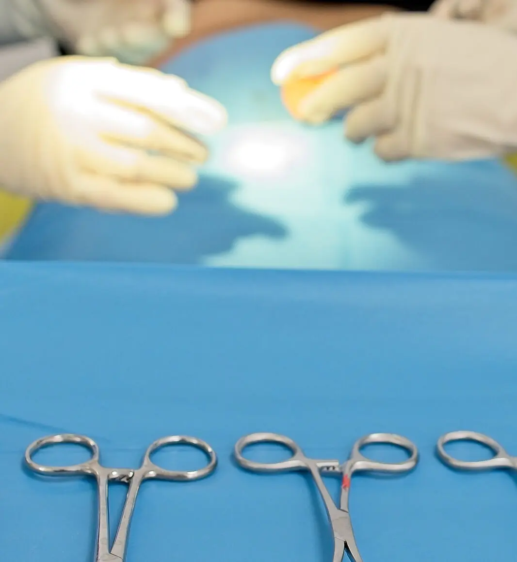 Operationsbesteck während einer Vasektomie.