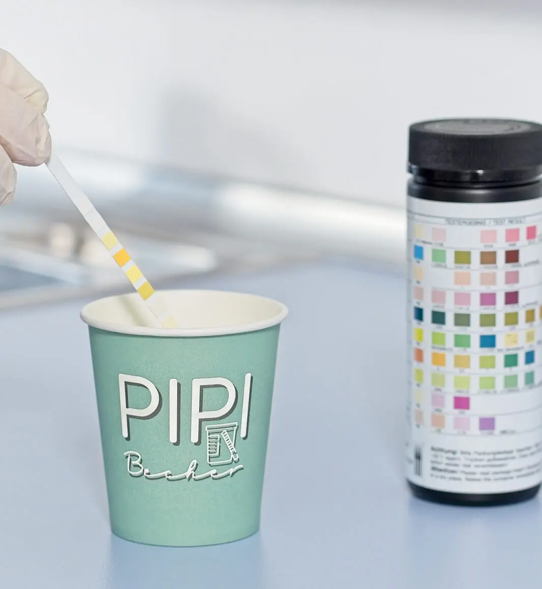 Urinanalyse auf Blasenkrebs