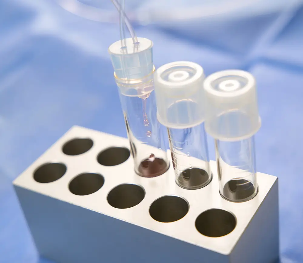 Laboruntersuchungen der Spermien beim Urologen