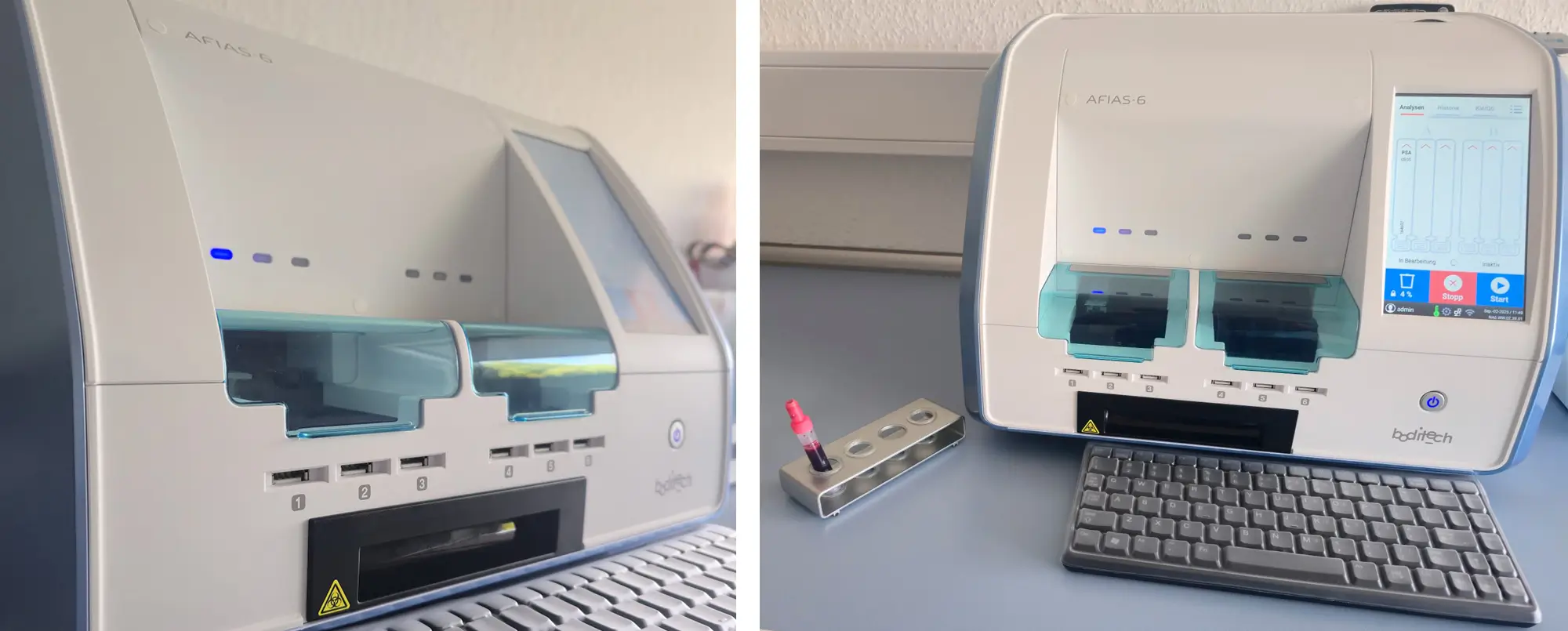 PSA Analysegerat im Labor